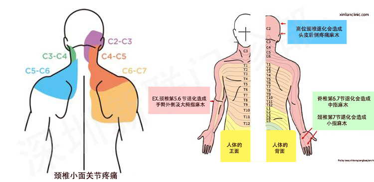 各种疼痛图片 分布图图片